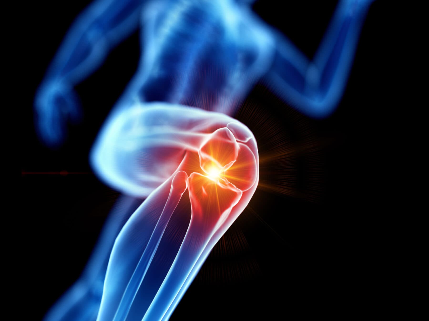 Yorkshire Sports Medicine