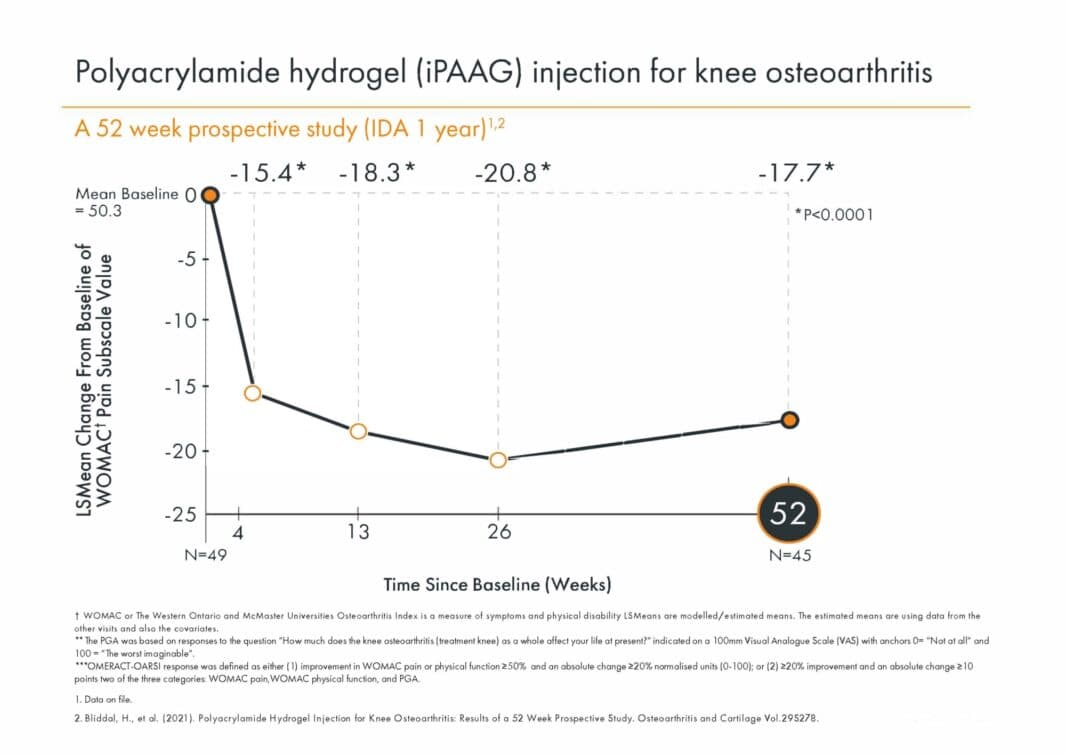 IDA 52 hafta grafiği