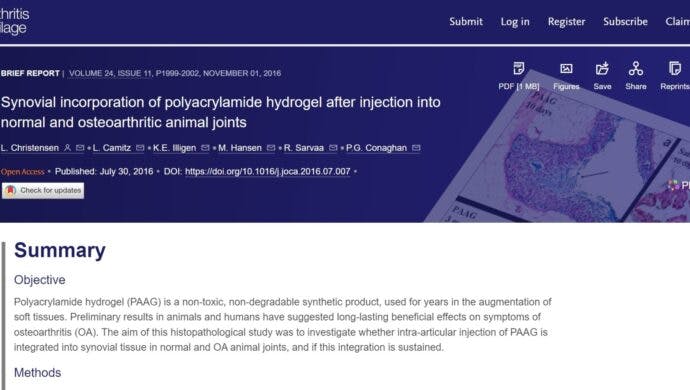Christensen synovial incorporation of polyacrylamide hydrogel into normal and OA animal joints